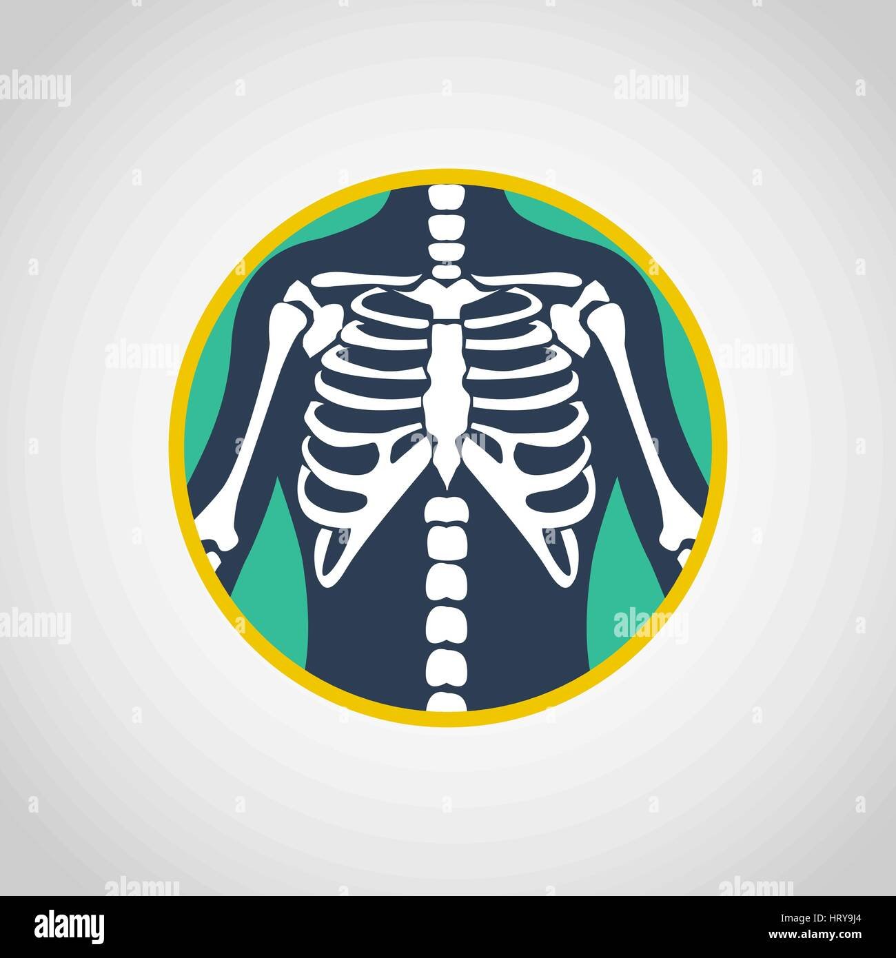 X   ray  